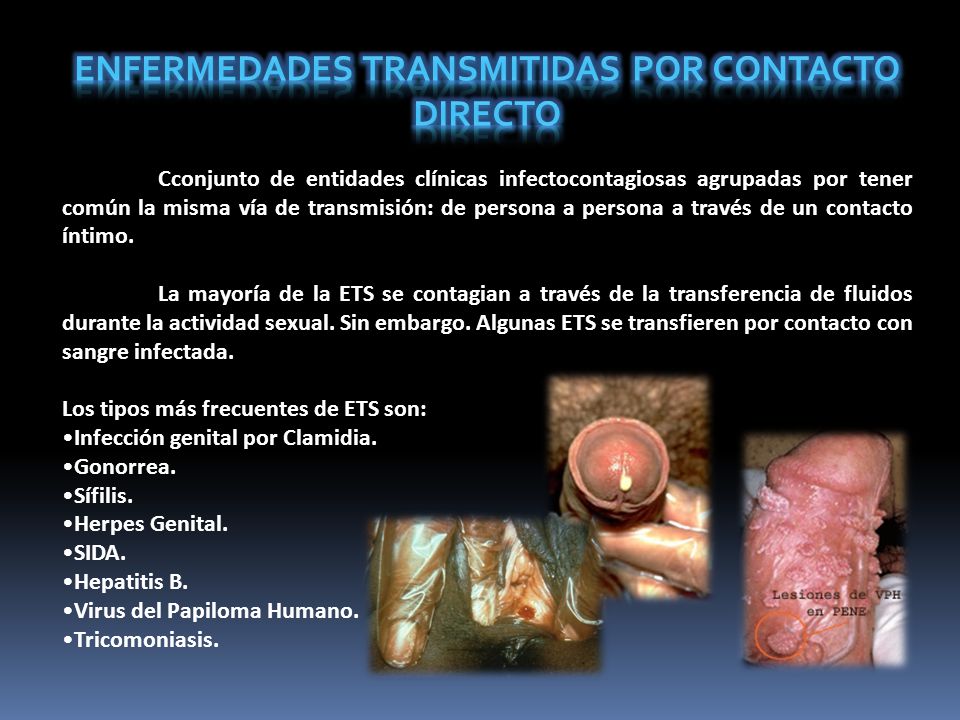 enfermedades que se contagian por contacto